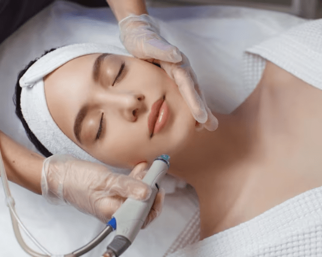 Chemical Peeling Treatment