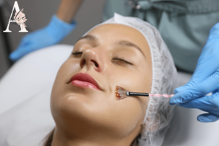 Chemical Peeling Work to Improve Skin Appearance