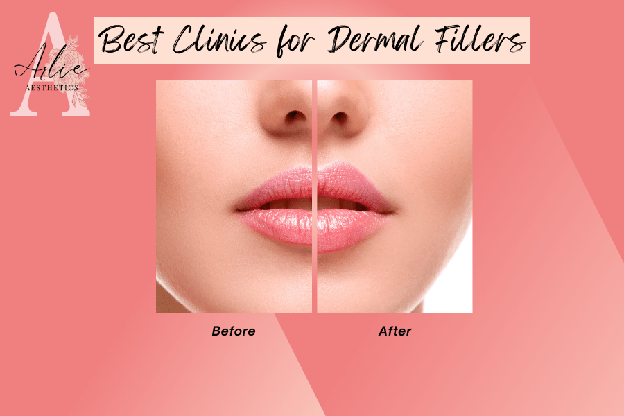 the Best Clinics for Dermal Fillers in Pittsburgh